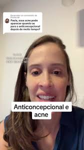 Respondendo a @Elcana Isli quem mais descobriu a acne depois de para o...