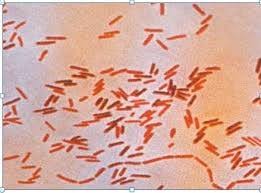 A microbial biorealm page on the genus salmonella typhi. Salmonella Typhi Www Medicoapps Org