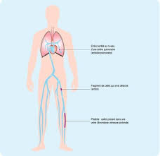 1er signe d'alerte des douleurs. Pathologies Reagir En Cas D Urgence Embolie Pulmonaire Ameli Fr Assure