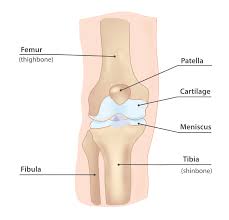What Is Patellofemoral Pain Syndrome Your Physio Online