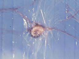 Gross anatomy the nasal cavity is formed by 1: Linguatula An Overview Sciencedirect Topics