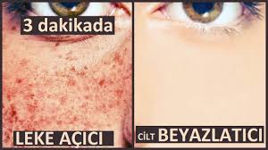 3 Dakikada Gunes Lekelerini Yok Et Cilt Beyazlatici Dogal Maske Guzellik Bakim Bayram Hediyesi Youtube Maskeler Yuzler Cilt Bakimi Tuyolari