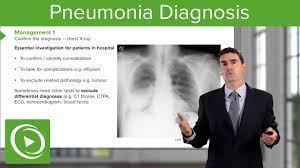 Pneumonia: Diagnosis & Principles Of Management – Respiratory Medicine |  Lecturio - Youtube