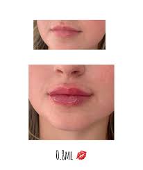 Helena Clinton Mir Aesthetics