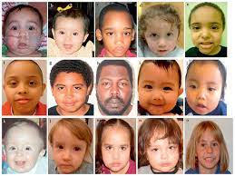 Facial Features Of Individuals With 16p11 2 Deletion A Case 1 B Download Scientific Diagram
