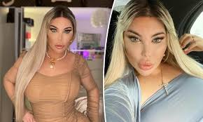 Jessica, 37, spoke exclusively to mailonline after the operation, revealing she is recovering at a facility in antalya and losing 'one kilo per day' while 'only consuming detox drinks'. Former Human Ken Doll Jessica Alves Has Had 75 Plastic Surgeries Amounting To A Million Dollars Daily Mail Online