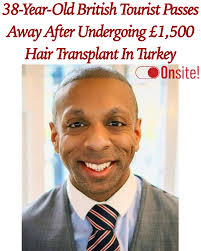 38-year-old British man #MartynLatchman tragically passes away after flying  to Turkey for a $1,500 hair transplant. According to reports, Martyn  suffered serious complications following the procedure and was rushed to the