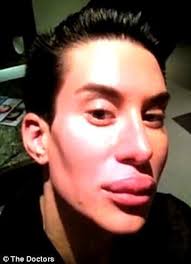Do plastic surgeons elect to undergo cosmetic surgery more than the average american? Man Spends 100 000 On Nearly 100 Plastic Surgery Operations To Become Real Life Ken Doll Plastic Surgery Plastic Surgery Gone Wrong Bad Plastic Surgeries