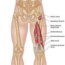 Проверьте 'hamstring injury' перевод на немецкий. Proximal Hamstring Tendinopathy Help And Support Home Facebook