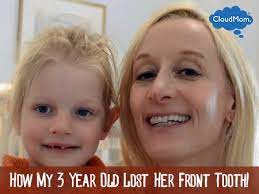 How My 3 Year Old Lost Her Front Tooth Front Teeth Losing Her 3 Years Old