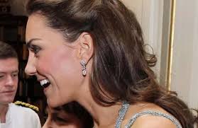 The Duchess of Cambridge has a massive scar