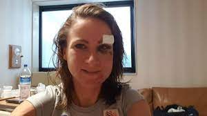 Welcome to women's cycling weekly issue 31 🚴‍♀️. Rio 2016 Twitter Destroys Man Who Tried To Explain Cycling To Olympian Who Suffered Horrific Crash