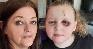 Mum of girl, 8, who suffers 300 seizures a day says daughter 'robbed of her  childhood'