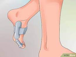 Tulang anggota gerak bawah dan fungsinya. Cara Menyembuhkan Jari Kaki Yang Patah 13 Langkah Dengan Gambar