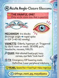 Image result for Acute Vision Loss