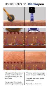 How To Use A Microneedling Dermapen At Home Starting Skincare Skin Needling Derma Pen Dermapen