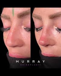 Dr. Kim Patrick Murray, MD