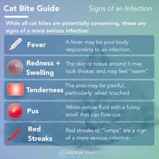For example, a temperature of 0 degrees fahrenheit and a wind speed of 15 mph creates a wind chill. 3 Charts Frost Bite On Your Face Statistics Prevention