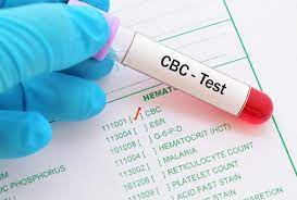 The cbc can evaluate your overall health and detect a variety of diseases and conditions, such as infections, anemia and leukemia. Cbc Test At Aarogyam Aarogyam
