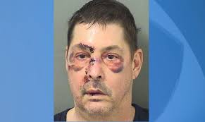 If you don't like the one that matches your birthday, why not adopt one of these tampa. Police Naked Florida Man Drove With Wires On Penis