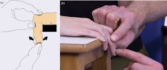 Image result for Elson Extensor Tendon Test