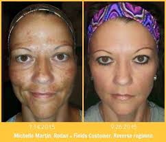 Profile for Ever After Skin