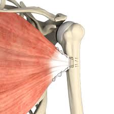 This muscle originates from the anterior. Pectoralis Major Tears Colorado Springs Pectoralis Major Repairs Colorado Springs
