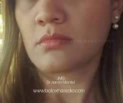 Cirujano Oral, Estética y Armonización