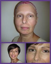 Facing the Mirror with Cancer