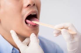 Throat cancer refers to cancer of the voice box, vocal cords, and other parts of the throat, such as the tonsils and the oropharynx. Strep Throat Or Sore Throat Best Ways You Can Tell Health Essentials From Cleveland Clinic