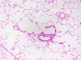 Please watch the video carefully and learn from lung histology diagram. Pathology Outlines Histology