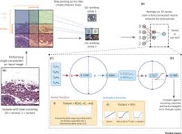 Of the 180,000, 32,000 result in death from the disease each year (american cancer society, 2015). Rise Of The Machines Advances In Deep Learning For Cancer Diagnosis Trends In Cancer