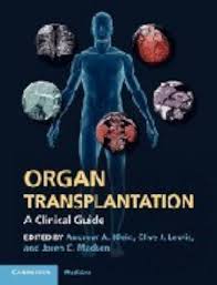 Image result for Transplantation