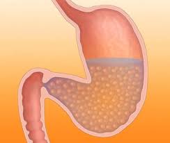 Image result for Plenity