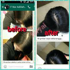 The finest oil comes from the fruits of the argania spinosa, harvested from the endangered argan forest of. Feryal Argan Oil Home Facebook