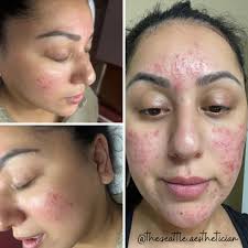 Joe Glow is a massage therapist, esthetician, and continuing education  provider from Oregon 🌲 Last weekend at The 2025 Skin Games, he  successfully defended his title of First Place in Facial Massage