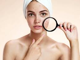 What causes dark spots on the face? How To Treat Dark Spots At Home The Times Of India