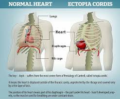 We cover the different bones that make up the rib cage and. 6 Ø§Ù†ØªØ¨Ø§Ø° Ø§Ù„Ù‚Ù„Ø¨