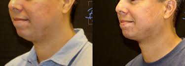 Eric Valladares, MD, Physician