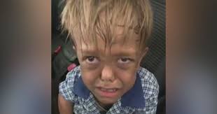 I Just Hope It's Not True': North Texan With Dwarfism Reacts To Theory That  9-Year-Old Boy Faked Being Bullied