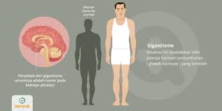We did not find results for: Gigantisme Tanda Dan Gejala Penyebab Cara Mengobati Cara Mencegah