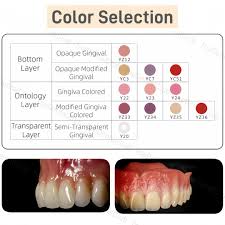 Image result for Gingiva