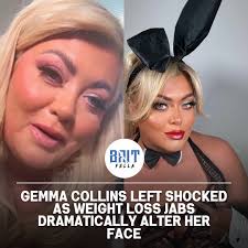 Gemma Collins has opened up about a surprising and distressing side effect  of her recent weight loss journey — a sudden change in her appearance. The  TOWIE star, 44, has been using