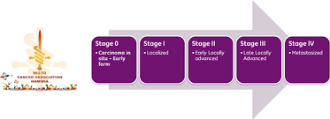 The stage of a cancer describes the size of a tumour and how far it has spread from where it originated. Stages Of Cancer Cancer Association Of Namibia Wo30