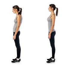 The ribs are higher than your abs so is there a way to strengthen your rib cage? Swayback Posture Risks And Treatment