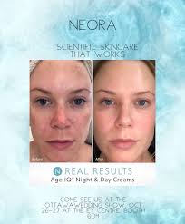 👩🏼‍⚕️Dr Sarah Hermer, wife, mom, cardiologist❣️, fellowship program  director, Neora national marketing director, and my Neora 'mom'.... gives  you 🔥 STRAIGHT TALK about this industry and Neora. Check out the video link