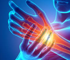 Image result for Pain Disorder