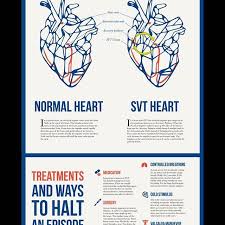 Pin On Heart Healthy Tips