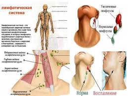 Prichiny Simptomy I Lechenie Vospaleniya Limfouzlov Oficialnyj Sajt Gbuz Rodilnyj Dom 2 G Magnitogorsk