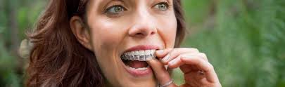 Adult Invisalign Treatment Santa Monica
